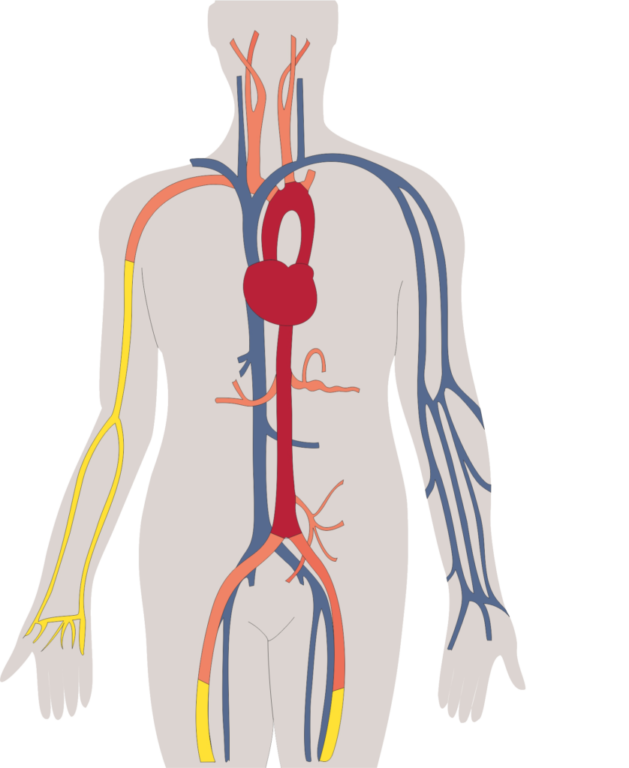Elastic-Resonance-Conduit Arteries