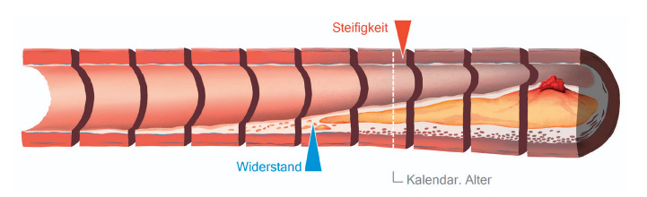 Darstellung der Arterienverkalkung und deren Einfluss auf die Pulswelle und Gefäßfunktion